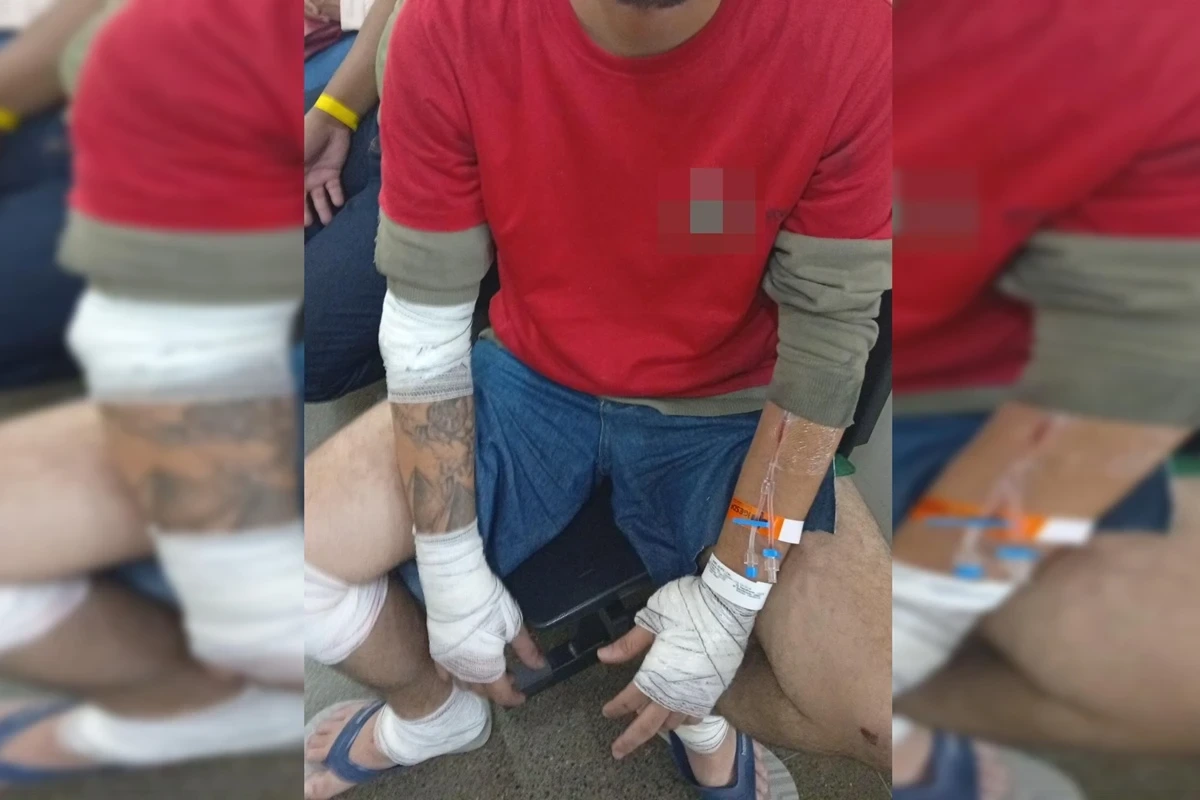 Motociclista quebra o baço após ser atingido por carro em via do DF